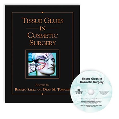 Cover for Renato Saltz · Tissue Glues in Cosmetic Surgery (Hardcover Book) (2004)