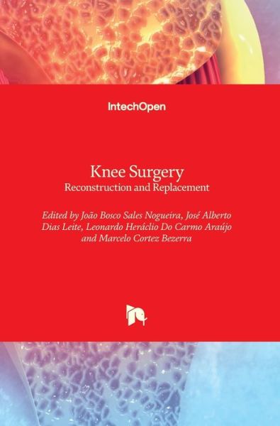 Cover for Joao Bosco Sales Nogueira · Knee Surgery: Reconstruction and Replacement (Hardcover Book) (2020)