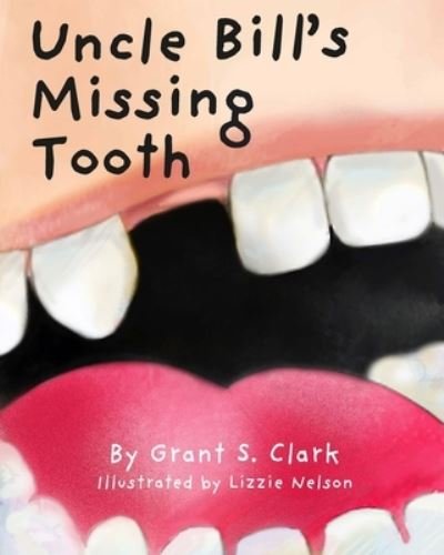 Cover for Grant Clark · Uncle Bill's Missing Tooth (Pocketbok) (2021)