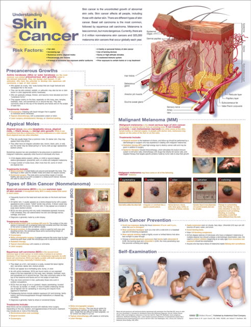 Cover for Anatomical Chart Com · Understanding Skin Cancer Anatomical Chart (Map) (2022)