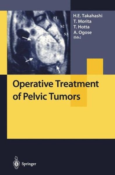 Operative Treatment of Pelvic Tumors - Tetsuo Hotta - Libros - Springer Verlag, Japan - 9784431703303 - 20 de septiembre de 2002