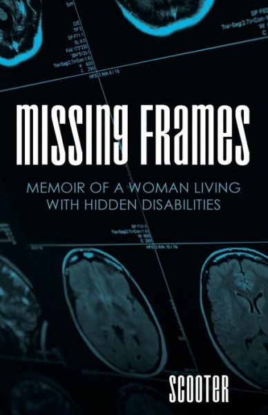 Missing Frames: Memoir of a Woman Living with Hidden Disabilities - Scooter - Livres - iUniverse - 9781491748305 - 18 juin 2015