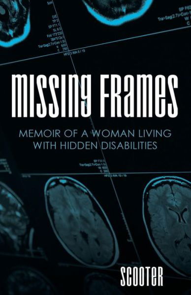 Cover for Scooter · Missing Frames: Memoir of a Woman Living with Hidden Disabilities (Paperback Bog) (2015)