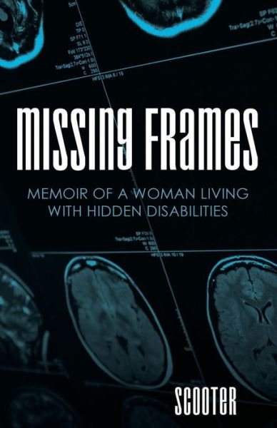 Cover for Scooter · Missing Frames: Memoir of a Woman Living with Hidden Disabilities (Paperback Book) (2015)