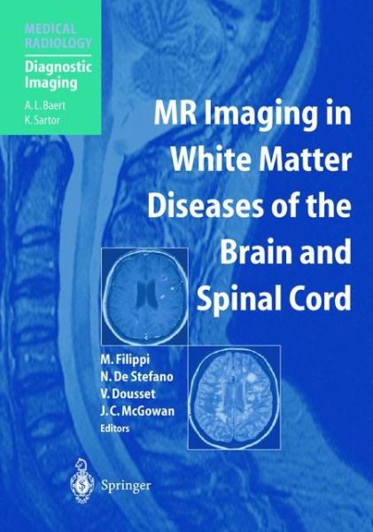 Cover for M Filippi · Mr Imaging in White Matter Diseases of the Brain and Spinal Cord - Medical Radiology / Diagnostic Imaging (Hardcover Book) (2005)