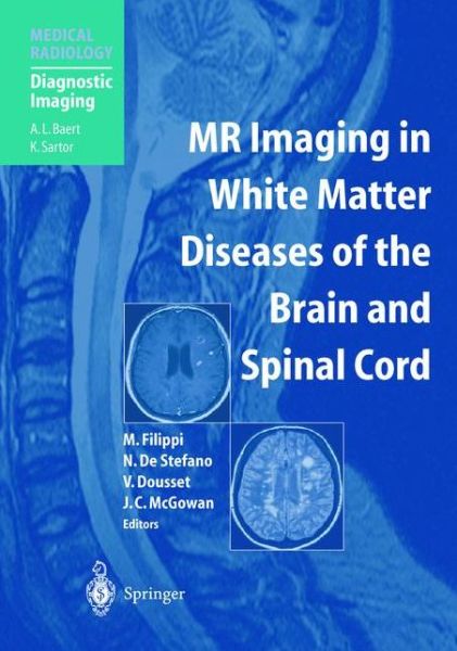 Mr Imaging in White Matter Diseases of the Brain and Spinal Cord - Medical Radiology / Diagnostic Imaging - M Filippi - Books - Springer-Verlag Berlin and Heidelberg Gm - 9783540402305 - May 9, 2005