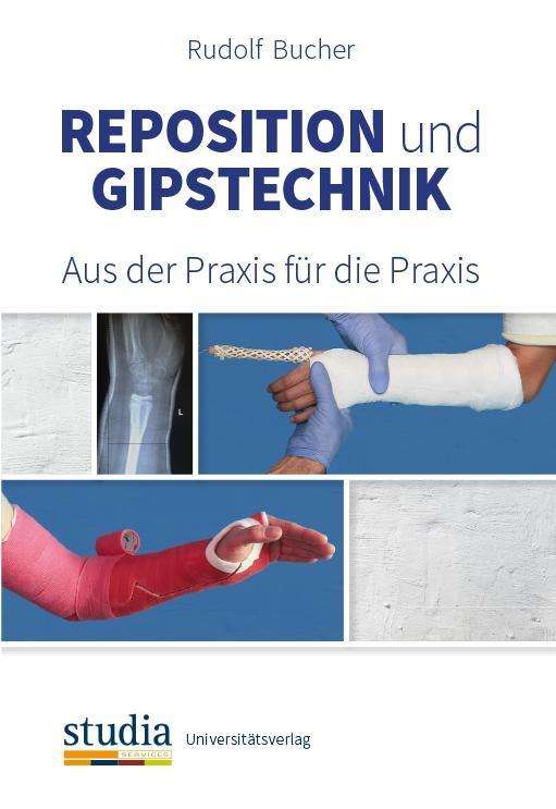 Cover for Bucher · Reposition und Gipstechnik (Book)