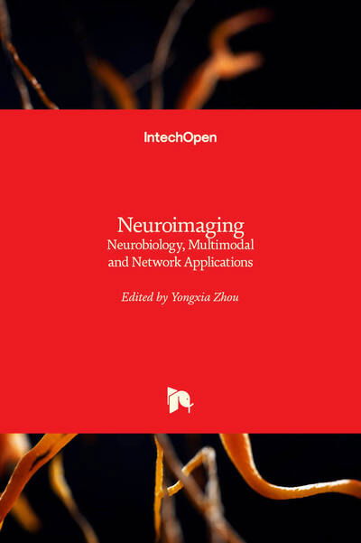 Cover for Yongxia Zhou · Neuroimaging (Hardcover Book) (2020)