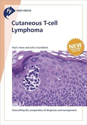 Cover for Haun · Fast Facts: Cutaneous T-cell Lymph (Book) (2019)