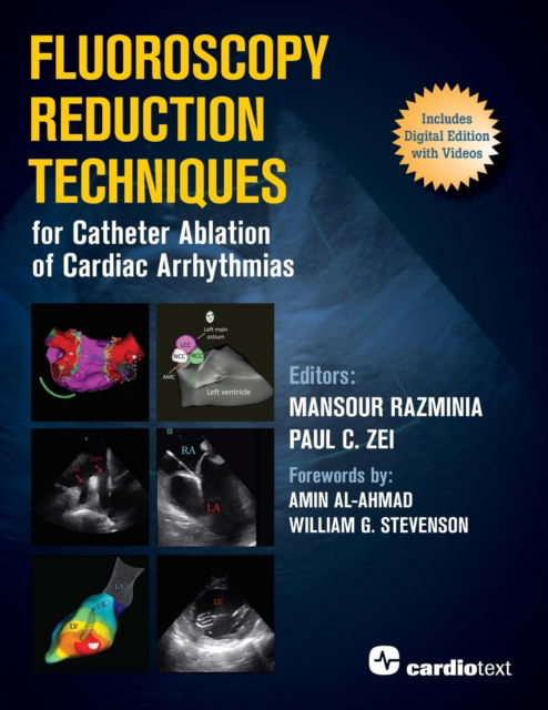 Cover for Mansour Razminia · Fluoroscopy Reduction Techniques for Catheter Ablation of Cardiac Arrhythmias (Paperback Book) (2019)