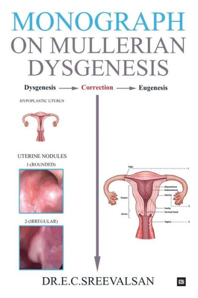 Cover for Dr E C Sreevalsan · Monograph on Mullerian Dysgenesis (Paperback Book) (2017)