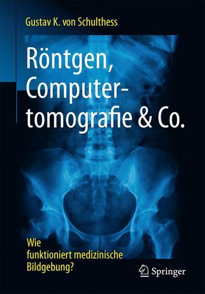 Cover for Gustav K Von Schulthess · Roentgen, Computertomografie &amp; Co.: Wie Funktioniert Medizinische Bildgebung? (Paperback Book) [1. Aufl. 2017 edition] (2016)