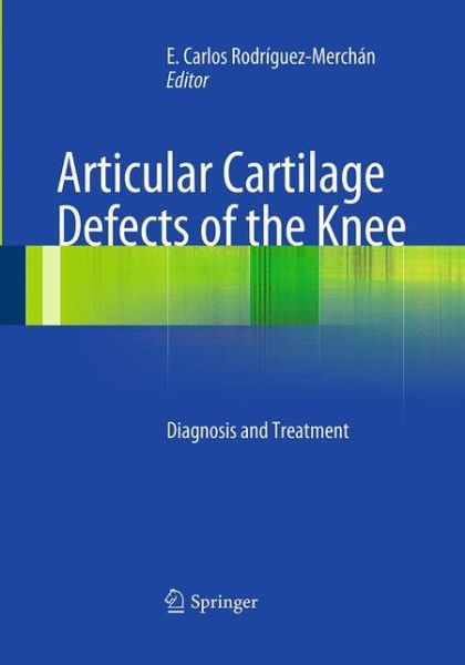 Cover for Articular Cartilage Defects of the Knee: Diagnosis and Treatment (Paperback Book) [Softcover reprint of the original 1st ed. 2012 edition] (2016)