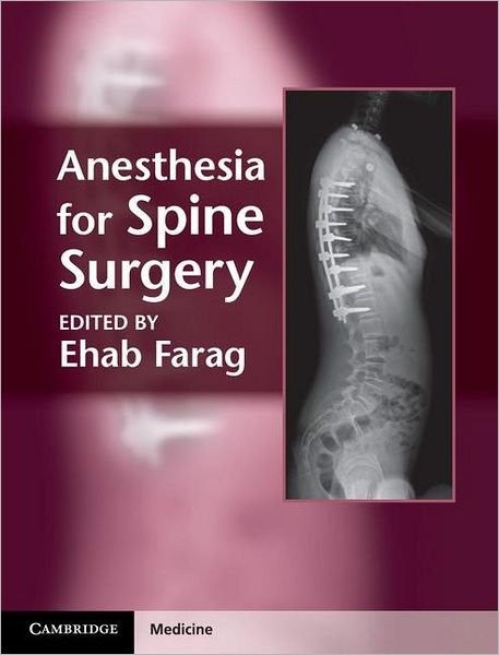 Cover for Ehab Farag · Anesthesia for Spine Surgery (Inbunden Bok) (2012)
