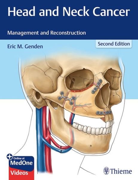 Head and Neck Cancer: Management and Reconstruction - Genden Eric M. - Books - Thieme Medical Publishers Inc - 9781626232310 - November 6, 2019