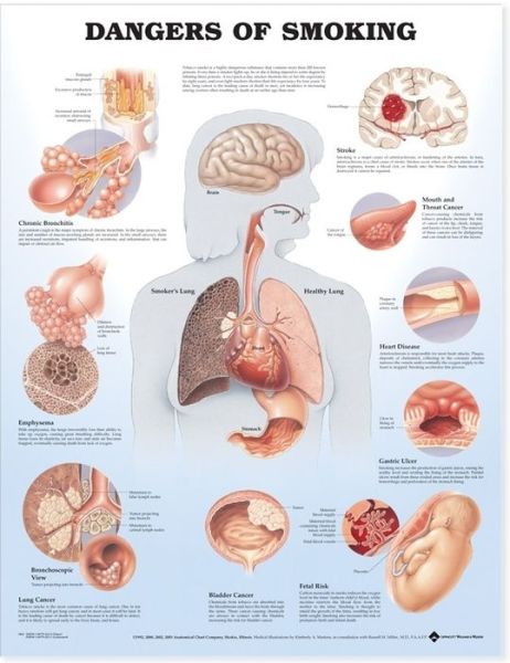 Dangers of Smoking Anatomical Chart - Anatomical Chart Com - Bücher - Anatomical Chart Co. - 9781587792311 - 9. Januar 2003