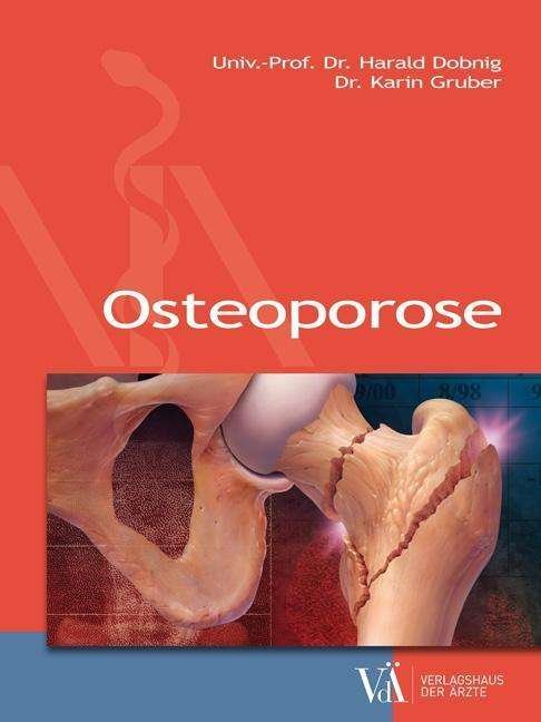 Cover for Dobnig · Osteoporose (Buch)