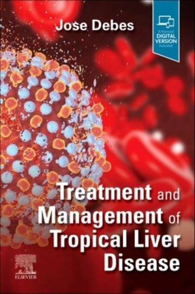 Cover for Treatment and Management of Tropical Liver Disease (Paperback Book) (2024)