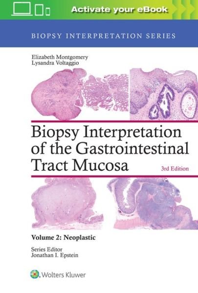 Cover for Elizabeth A. Montgomery · Biopsy Interpretation of the Gastrointestinal Tract Mucosa: Volume 2: Neoplastic - Biopsy Interpretation Series (Hardcover Book) (2017)