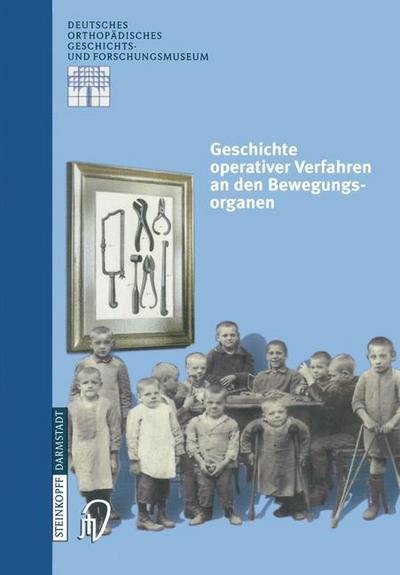 Cover for Zichner  L. · Geschichte Operativer Verfahren an den (Pocketbok) (2000)