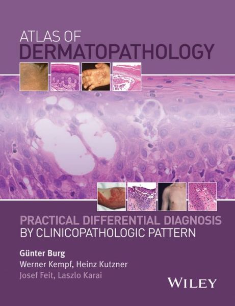 Cover for G Burg · Atlas of Dermatopathology: Practical Differential Diagnosis by Clinicopathologic Pattern (Hardcover Book) (2015)