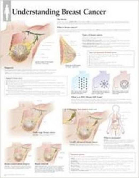 Understanding Breast Cancer Laminated Poster - Scientific Publishing - Livros - Scientific Publishing Limited - 9781935612315 - 2 de abril de 2013