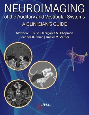 Cover for Neuroimaging of the Auditory and Vestibular Systems: A Clinician’s Guide (Inbunden Bok) (2024)