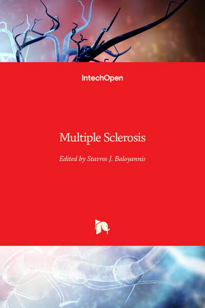 Cover for Stavros J. Baloyannis · Multiple Sclerosis (Hardcover Book) (2020)