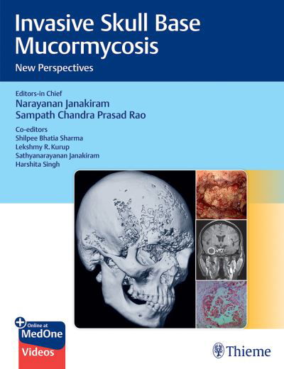 Invasive Skull Base Mucormycosis: New Perspectives -  - Livros - Thieme Publishers Delhi - 9789395390316 - 28 de outubro de 2024