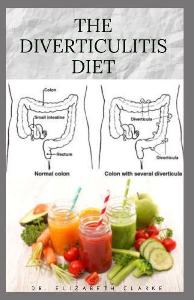 Cover for Dr Elizabeth Clarke · The Diverticulitis Diet (Paperback Book) (2020)