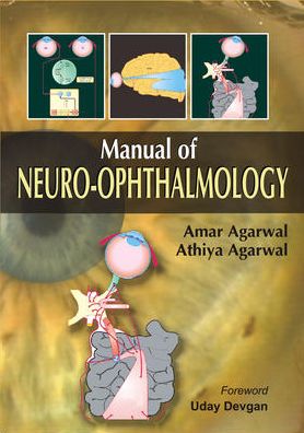 Cover for Amar Agarwal · Manual of Neuro-Ophthalmology (Paperback Book) [Ed edition] (2009)