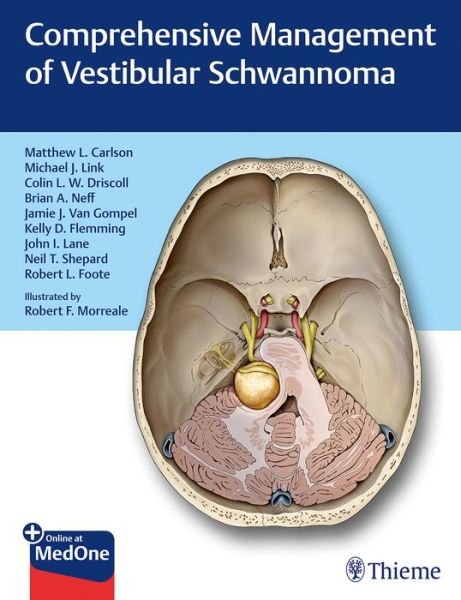Comprehensive Management of Vestibular Schwannoma - Matthew L. Carlson - Livros - Thieme Medical Publishers Inc - 9781626233317 - 7 de agosto de 2018