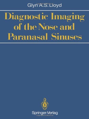 Cover for Glyn A.S. Lloyd · Diagnostic Imaging of the Nose and Paranasal Sinuses (Paperback Book) [Softcover reprint of the original 1st ed. 1988 edition] (2011)