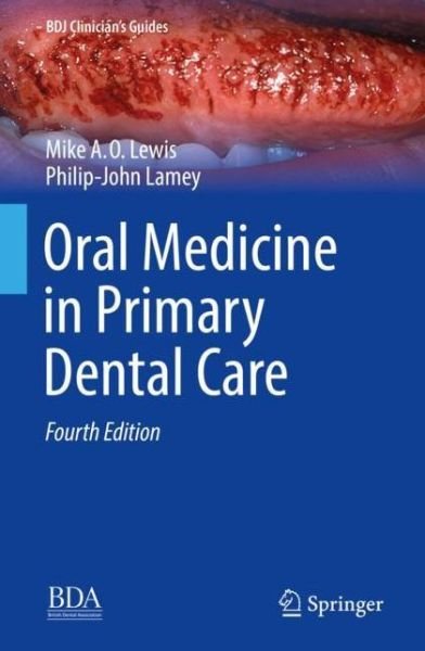 Cover for Lewis · Oral Medicine in Primary Dental Care (Bog) [4th ed. 2019 edition] (2019)