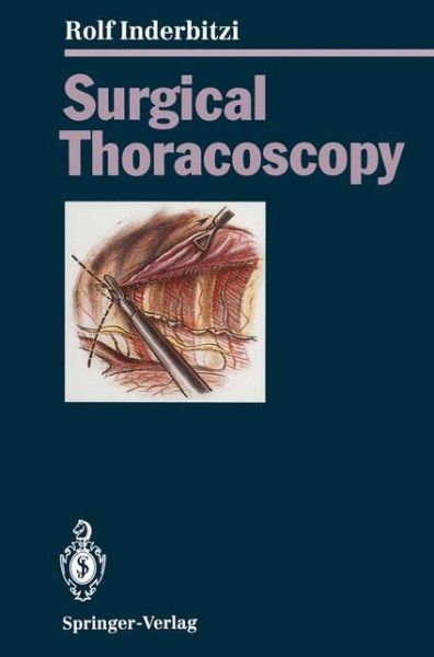 Cover for Rolf Gilbert Carl Inderbitzi · Surgical Thoracoscopy (Paperback Book) [Softcover reprint of the original 1st ed. 1994 edition] (2011)