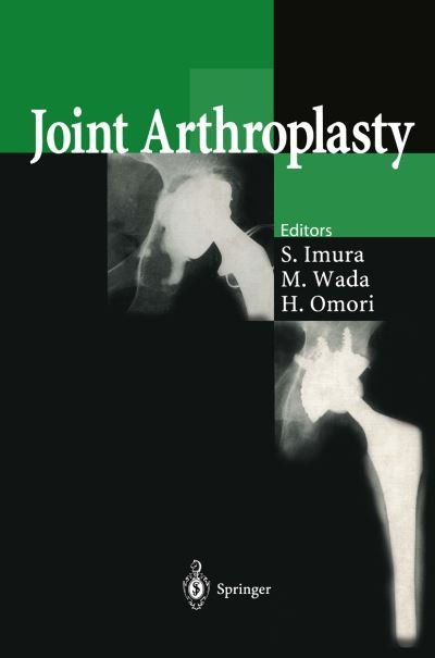Cover for Shinichi Imura · Joint Arthroplasty (Paperback Book) [Softcover reprint of the original 1st ed. 1999 edition] (2014)