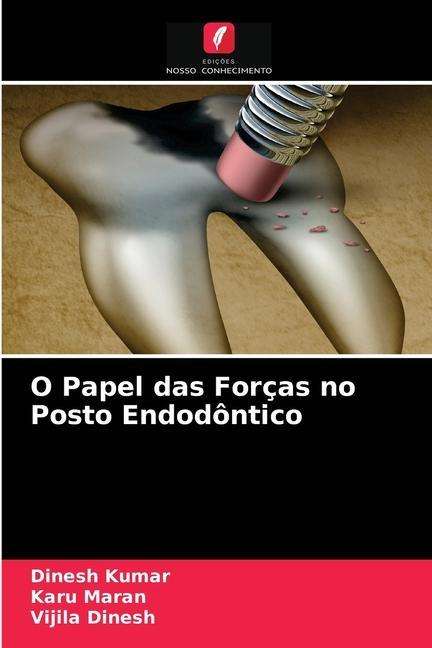 Cover for Kumar · O Papel das Forças no Posto Endod (N/A) (2021)