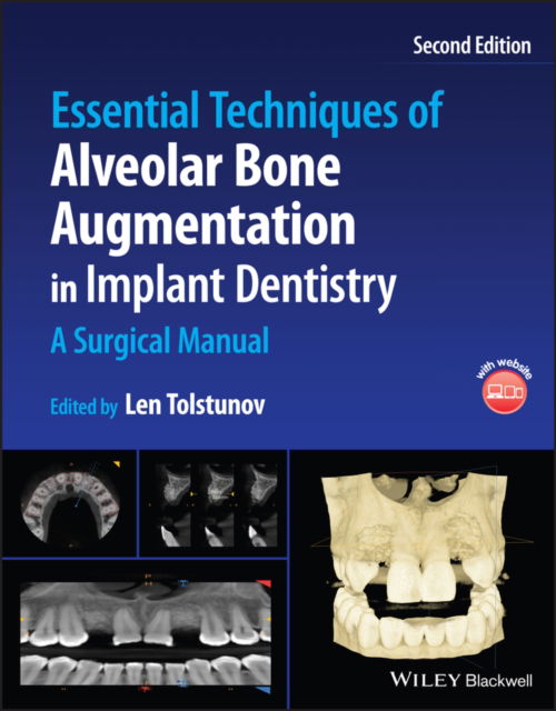 Cover for Tolstunov · Essential Techniques of Alveolar Bone Augmentation in Implant Dentistry: A Surgical Manual (Hardcover Book) (2022)