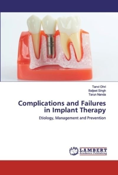 Cover for Ohri · Complications and Failures in Impl (Bok) (2020)