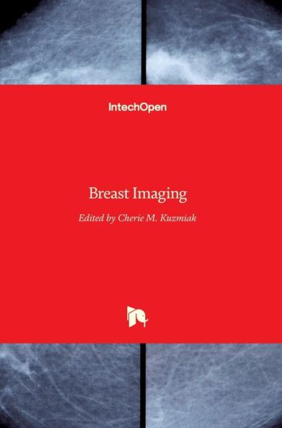 Cover for Cherie M Kuzmiak · Breast Imaging (Hardcover bog) (2018)