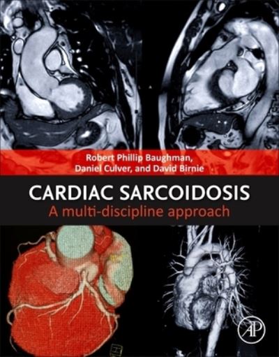 Cardiac Sarcoidosis: A Multi-discipline Approach - Robert Phillip Baughman - Książki - Elsevier Science Publishing Co Inc - 9780128223321 - 1 marca 2025