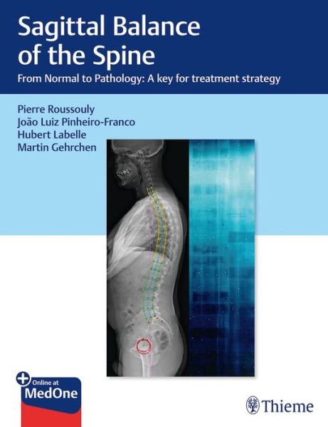 Sagittal Balance of the Spine: From Normal to Pathology: A Key for Treatment Strategy - Roussouly Pierre - Bøger - Thieme Medical Publishers Inc - 9781626237322 - 23. oktober 2019