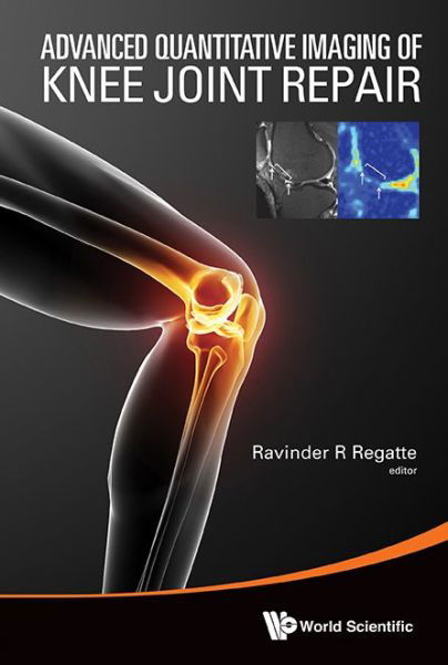 Advanced Quantitative Imaging Of Knee Joint Repair - Ravinder R Regatte - Bücher - World Scientific Publishing Co Pte Ltd - 9789814579322 - 20. Mai 2014