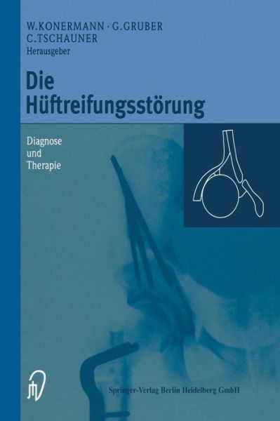 Cover for Konermann  Werner · Die Huftreifungsstoerung: Diagnose Und Therapie (Hardcover Book) [1999 edition] (1998)