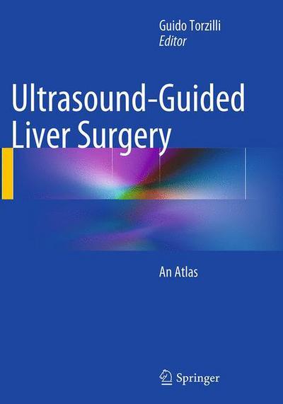 Cover for Ultrasound-Guided Liver Surgery: An Atlas (Paperback Book) [Softcover reprint of the original 1st ed. 2014 edition] (2016)