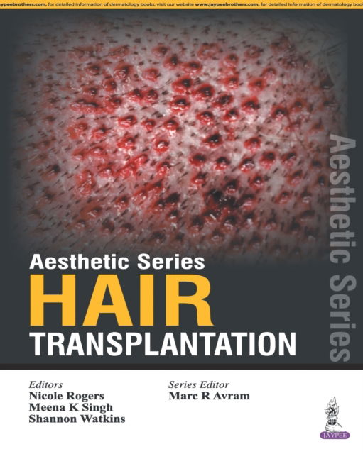 Cover for Aesthetic Series - Hair Transplantation (Gebundenes Buch) (2015)