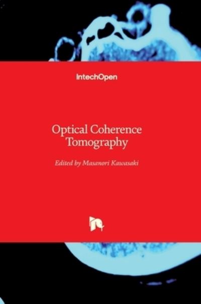 Cover for Masanori Kawasaki · Optical Coherence Tomography (Hardcover Book) (2013)