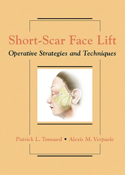 Cover for Tonnard, Patrick, MD · Short-Scar Face Lift: Operative Strategies and Techniques (Hardcover Book) (2007)