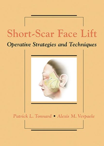 Short-Scar Face Lift: Operative Strategies and Techniques - Tonnard, Patrick, MD - Books - Thieme Medical Publishers Inc - 9781626236325 - July 1, 2007