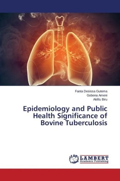 Cover for Akililu Biru · Epidemiology and Public Health Significance of Bovine Tuberculosis (Paperback Bog) (2014)